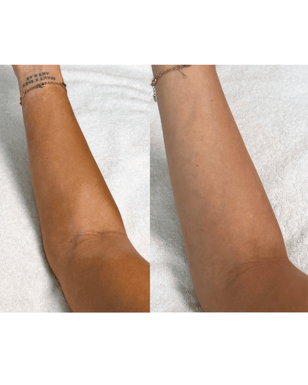 SELF TAN