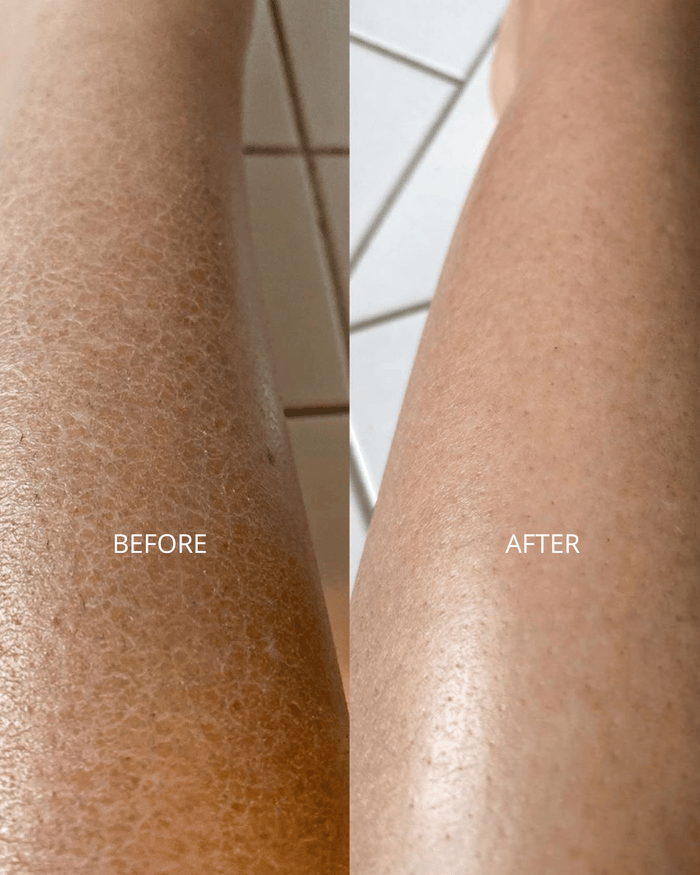 Dry / Dull Skin