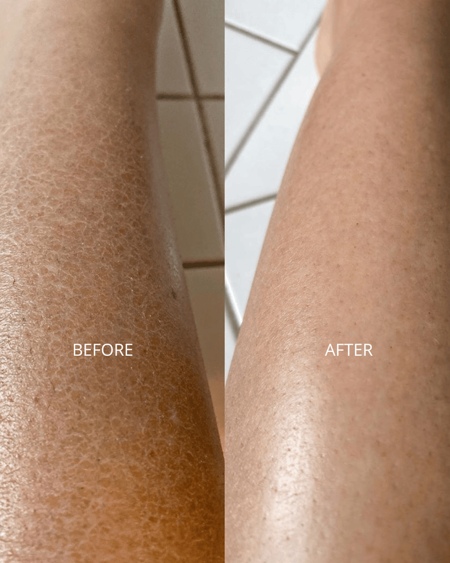 Dry / Dull Skin
