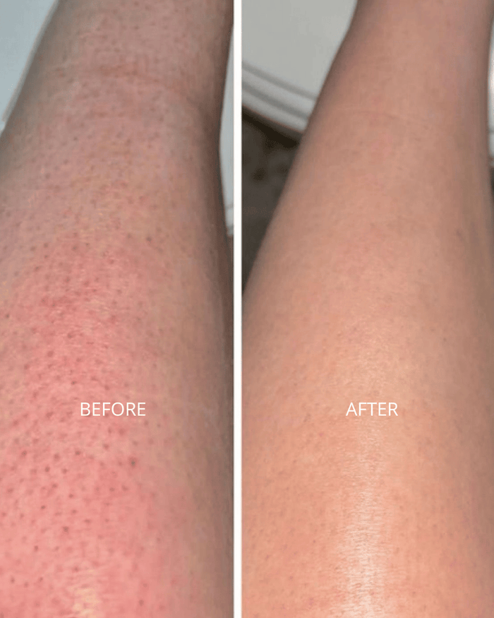 Strawberry skin